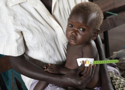 Голодные дети Африки